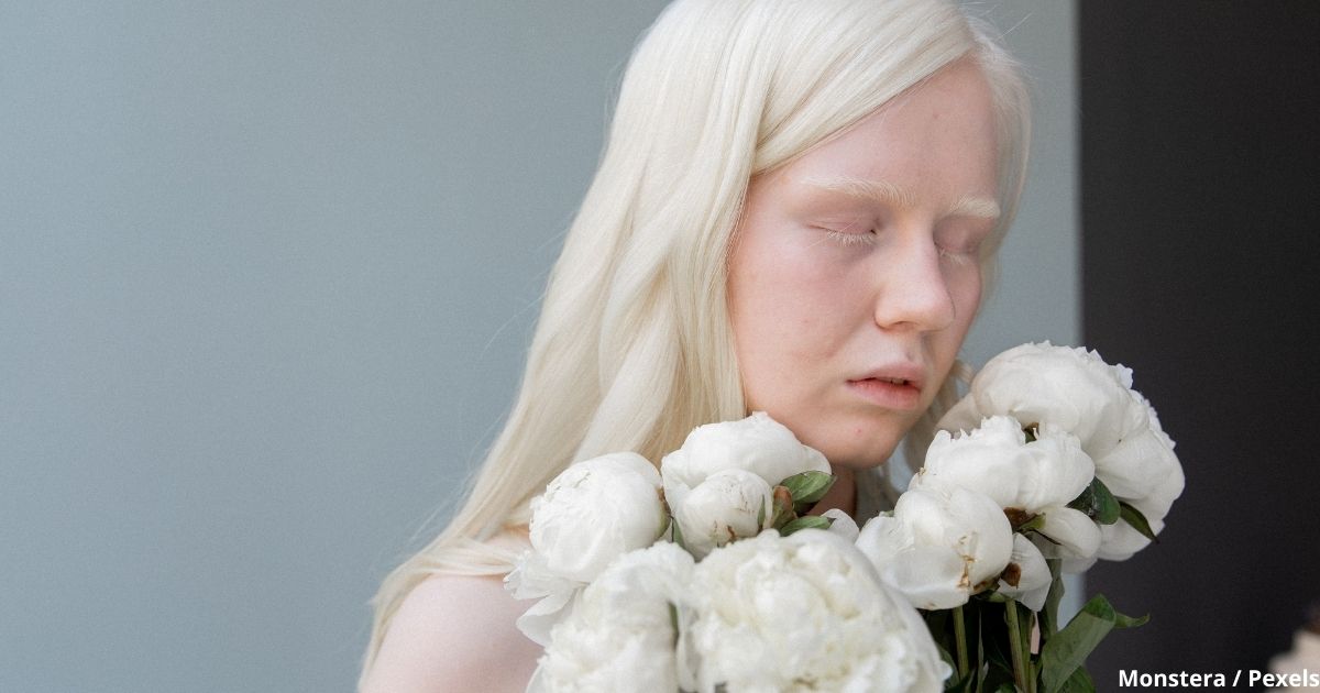 Рожденные быть другими: ТОП-5 самых известных моделей-альбиносов